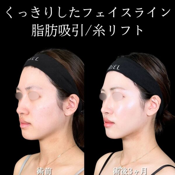 No.16487の症例写真
